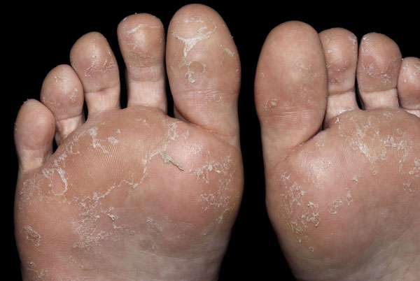 The Practitioner 1868 2020 Supporting General Practitioners For More Than 150 Years Skin Conditions In Children